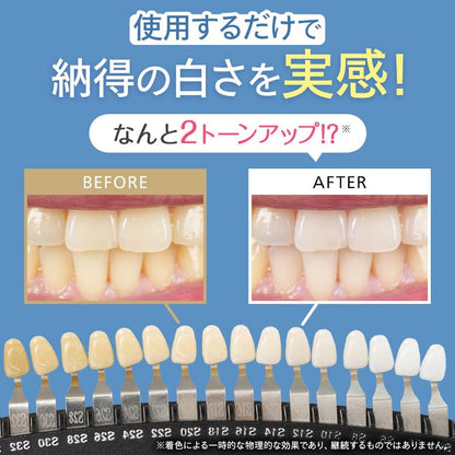 YUME V CRYSTAL｜黄ばみ・着色汚れを落として白い歯へ導くホワイトニング歯磨きジェル